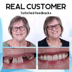 SmileNest™ — Rediscover Joy with a Denture Fit So Natural It Feels Like You Again