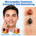 Aurevia™ — Reveal Smooth, Flawless Skin Without Pain or Hassle