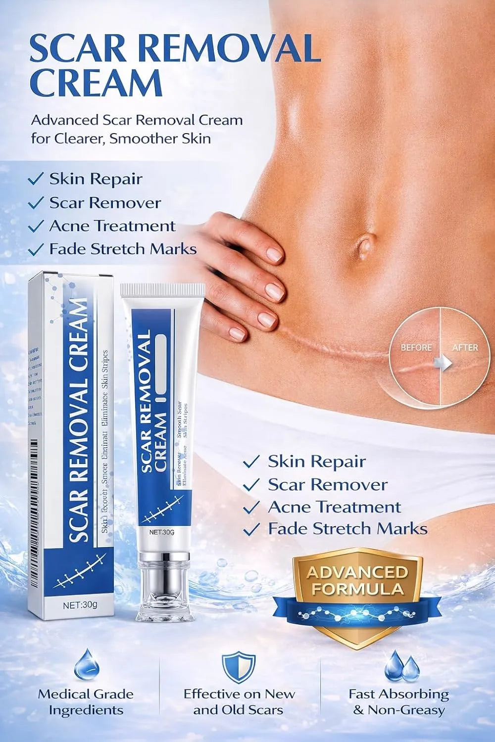 DermaLux™ Scar Renewal Gel — Unleash Flawless Skin and Confidence in Weeks